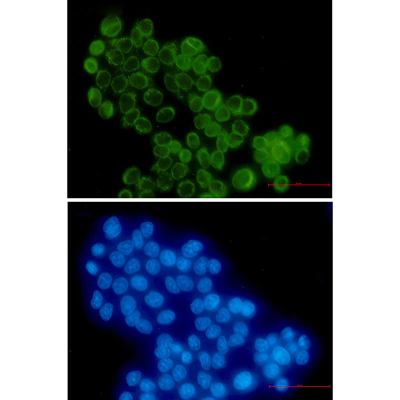 RanGAP1 Rabbit mAb ABZ2476