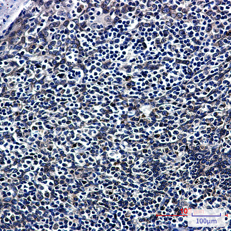 RanGAP1 Rabbit mAb ABZ2476