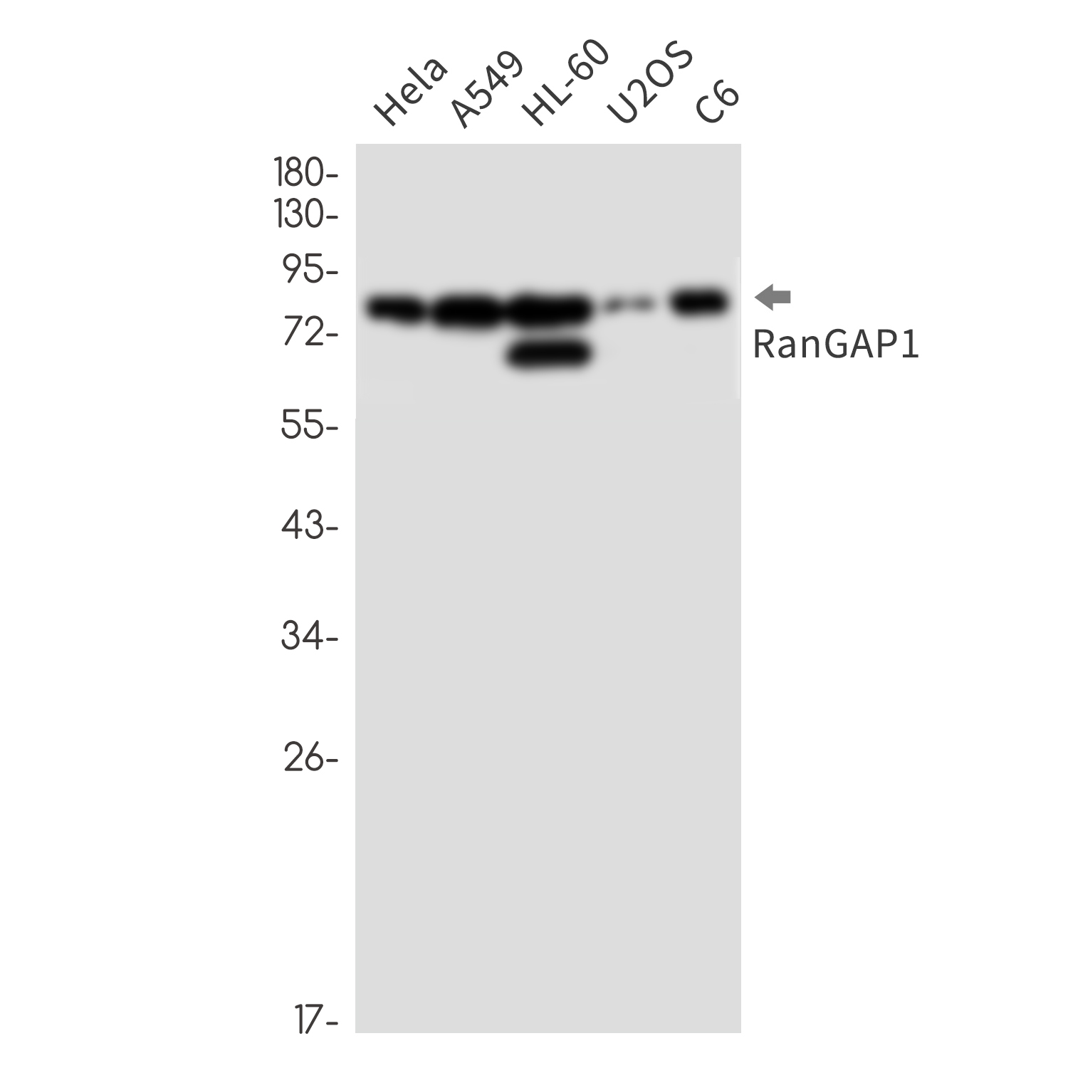 RanGAP1 Rabbit mAb ABZ2476