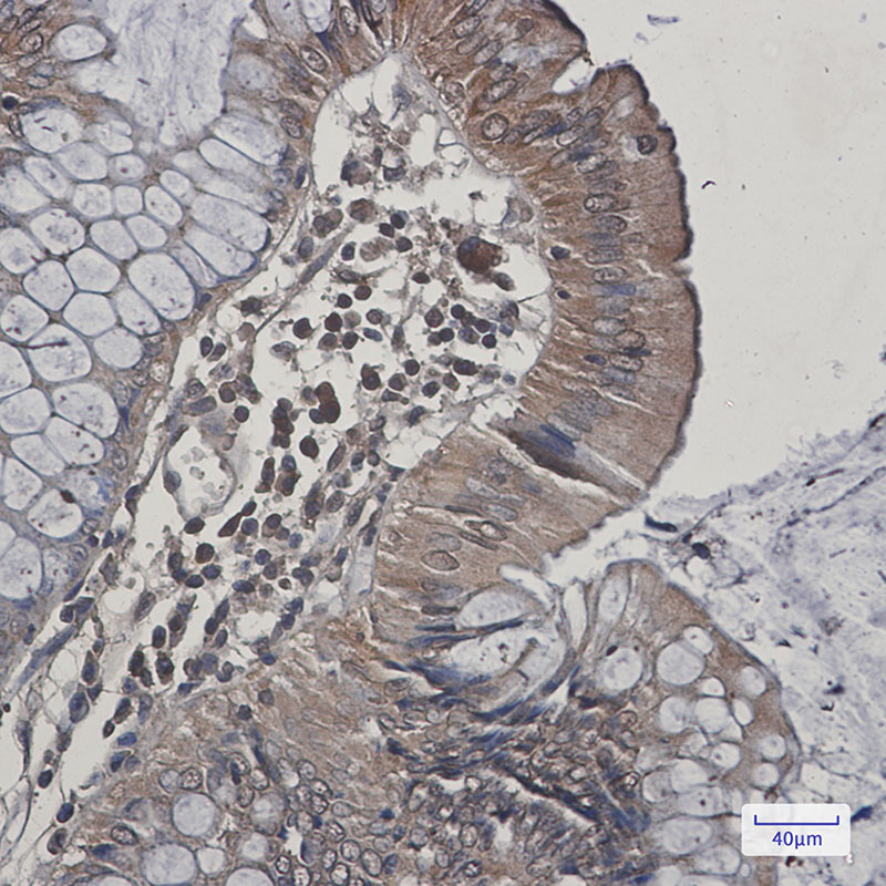 JNK2 Rabbit mAb ABZ2477