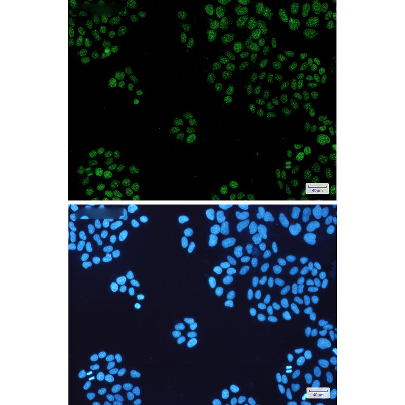 HP1 alpha Rabbit mAb ABZ2481