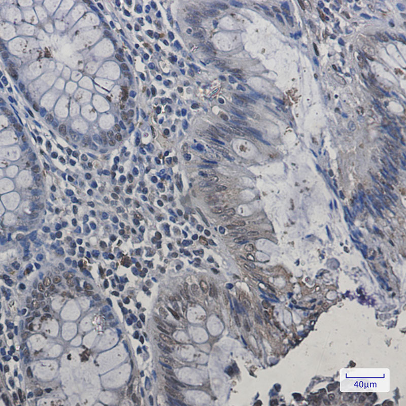 HP1 alpha Rabbit mAb ABZ2481