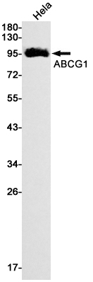 ABCG1 Rabbit mAb ABZ2482