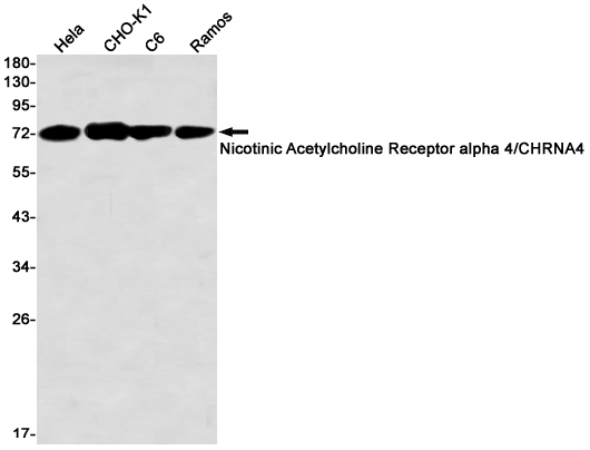 Nicotinic Acetylcholine Receptor alpha 4 Rabbit mAb ABZ2483