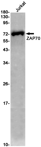 ZAP70 Rabbit mAb ABZ2484