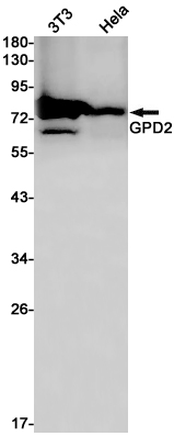 GPD2 Rabbit mAb ABZ2485