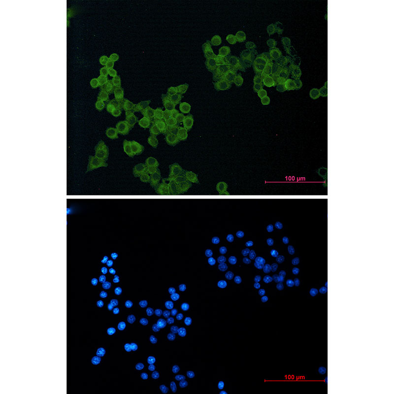 CD146 Rabbit mAb ABZ2488