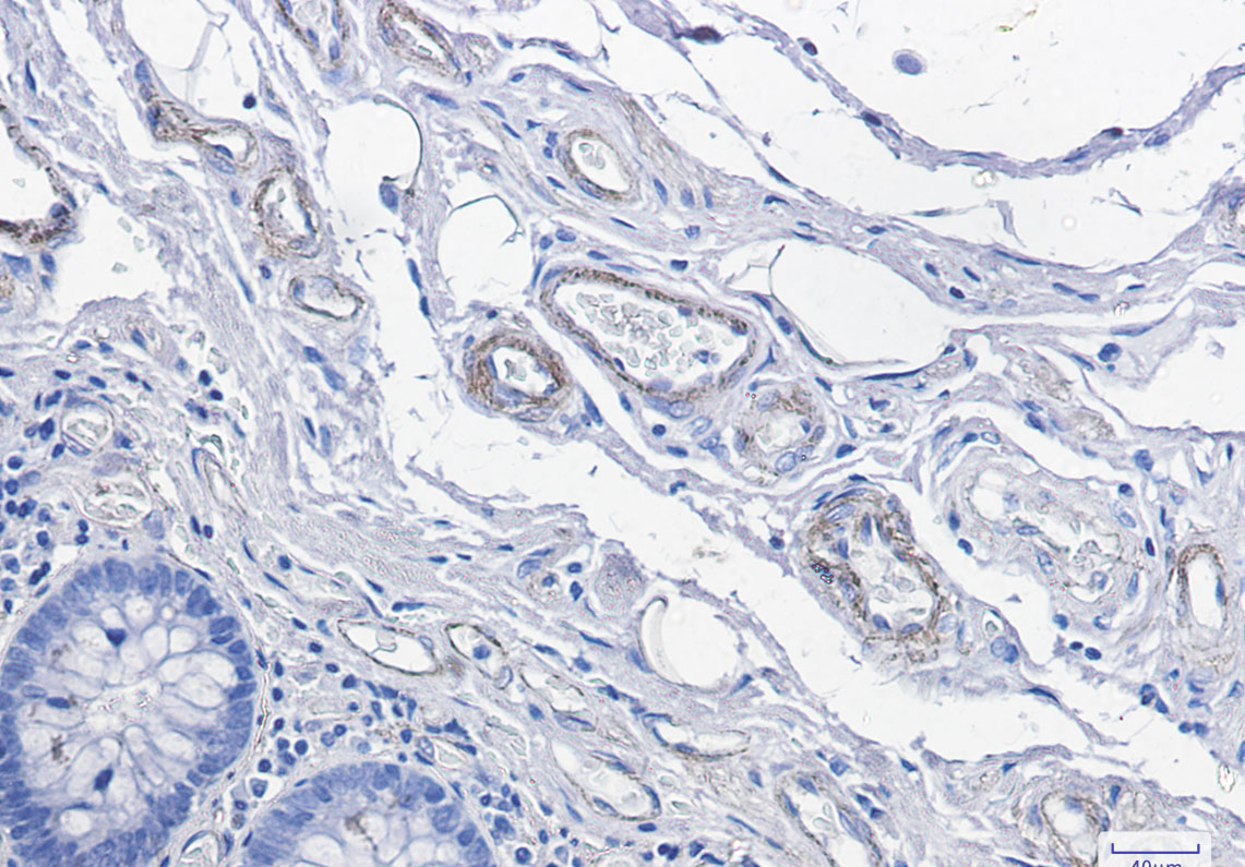 CD146 Rabbit mAb ABZ2488