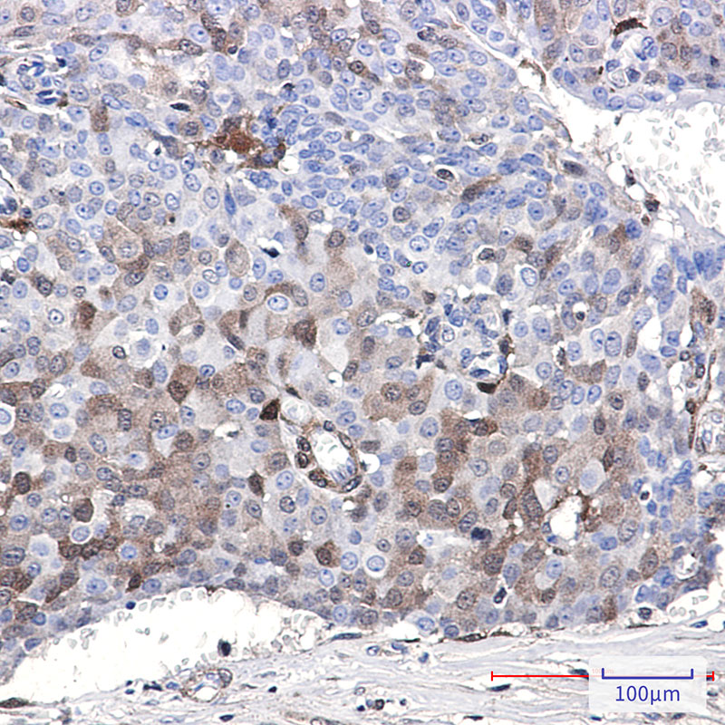 p18 INK4c/CDKN2C Rabbit mAb ABZ2490