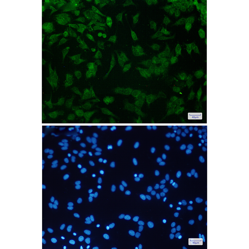 CDKN2A/p16INK4a Rabbit mAb ABZ2491