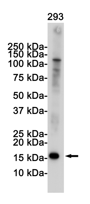 CDKN2A/p16INK4a Rabbit mAb ABZ2491