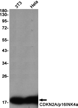 CDKN2A/p16INK4a Rabbit mAb ABZ2491