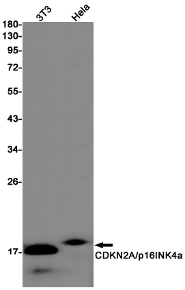 CDKN2A/p16INK4a Rabbit mAb ABZ2492
