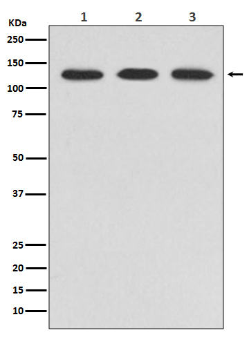 ABL2 Rabbit mAb ABZ2493