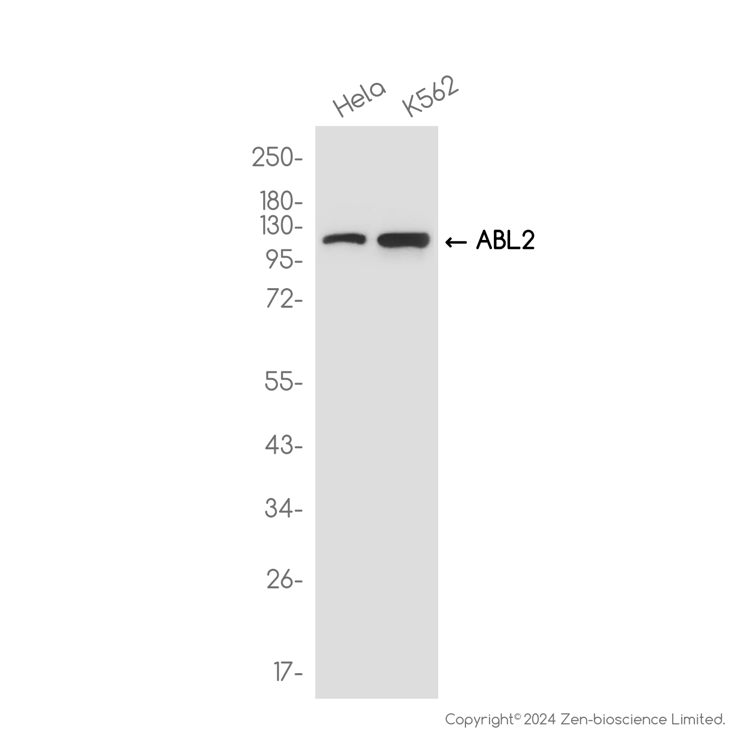 ABL2 Rabbit mAb ABZ2493