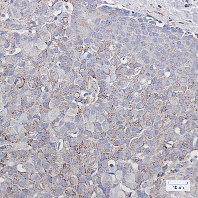 Glutamate receptor 2 Rabbit mAb ABZ2499