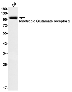 Glutamate receptor 2 Rabbit mAb ABZ2499