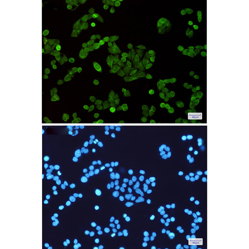 STAT5 Rabbit mAb ABZ2500