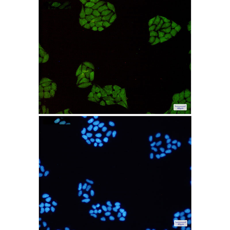 STAT1 Rabbit mAb ABZ2502
