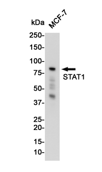 STAT1 Rabbit mAb ABZ2502