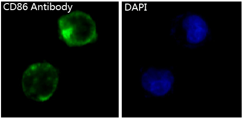 CD86 Rabbit mAb ABZ2504