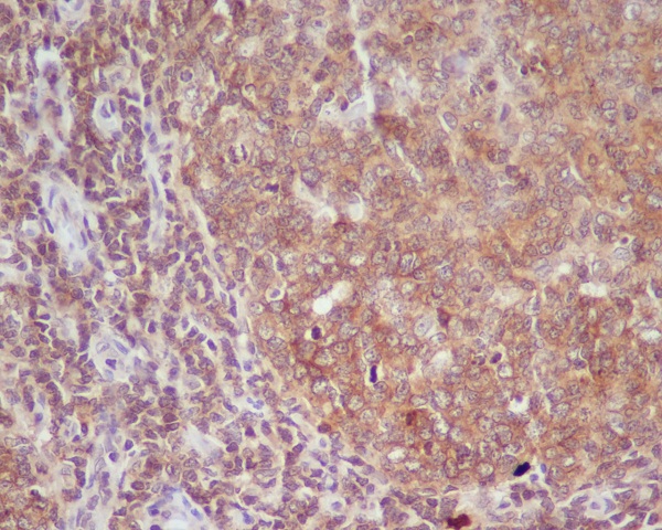 CD86 Rabbit mAb ABZ2504