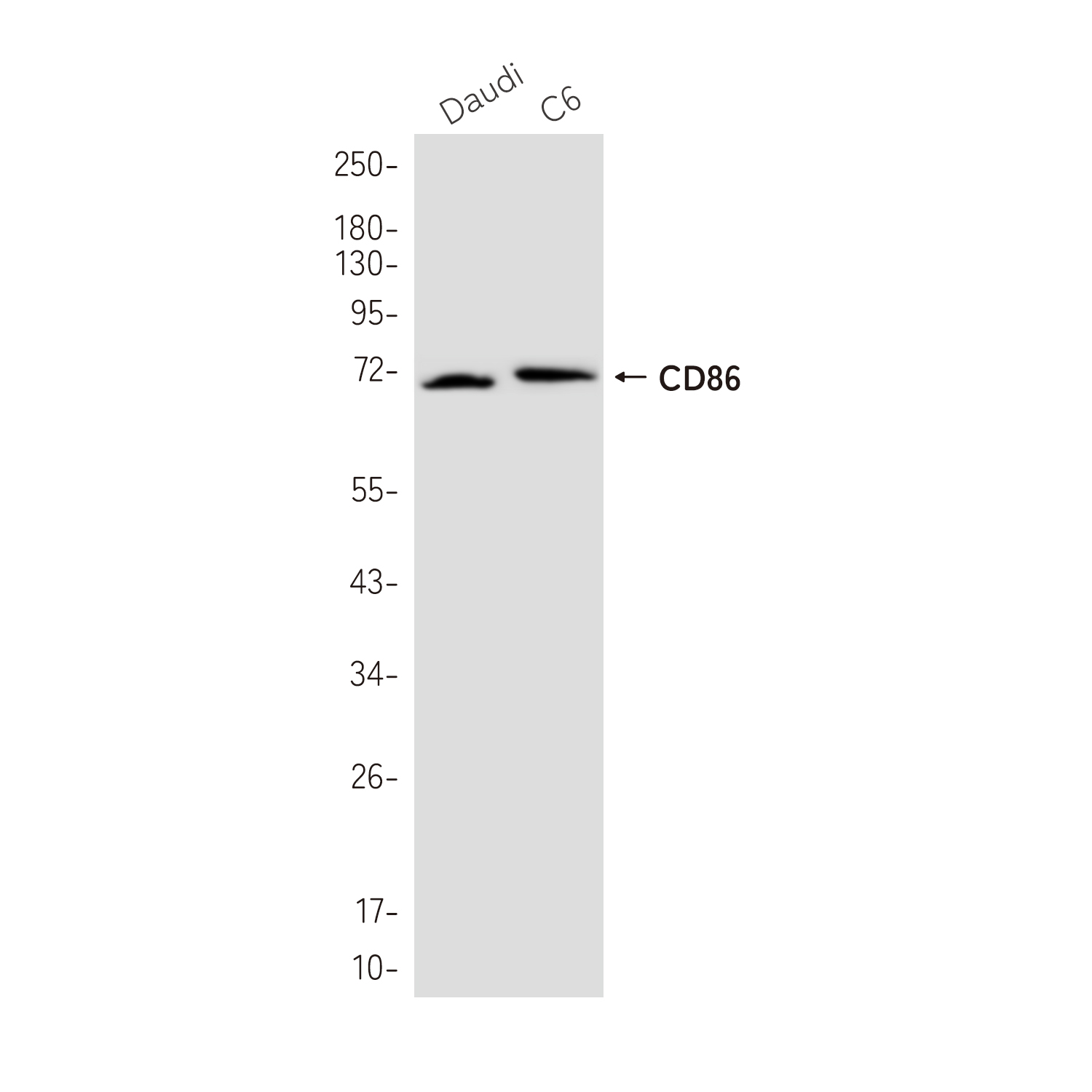 CD86 Rabbit mAb ABZ2504