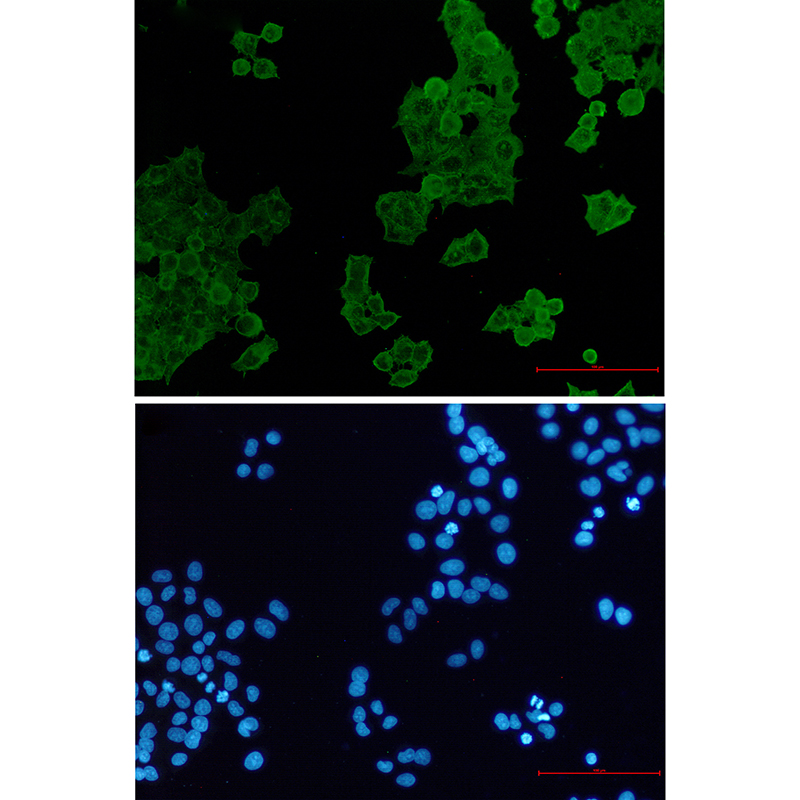 ACTR1B Rabbit mAb ABZ2505