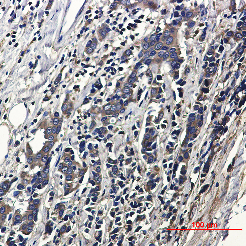 ACTR1B Rabbit mAb ABZ2505