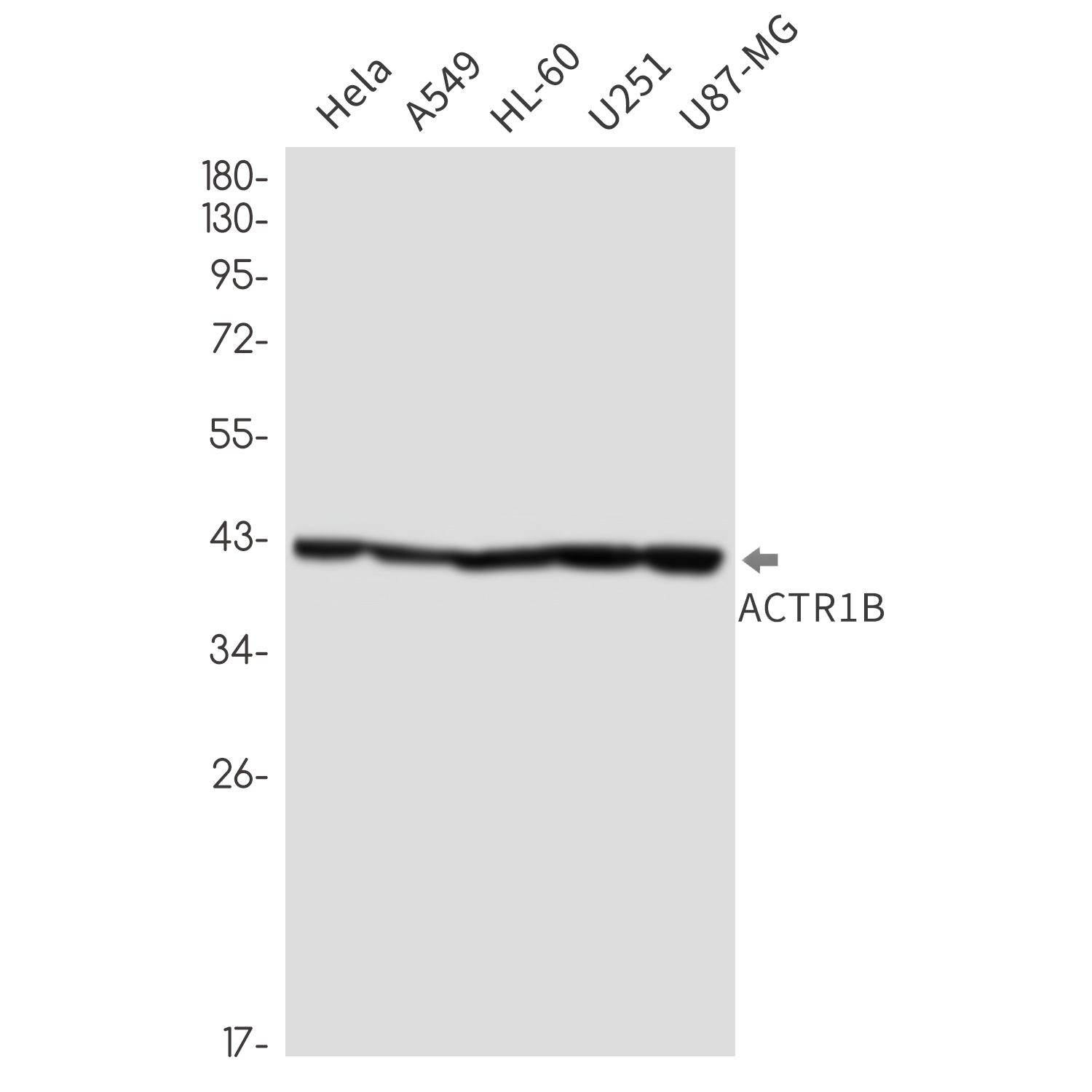 ACTR1B Rabbit mAb ABZ2505