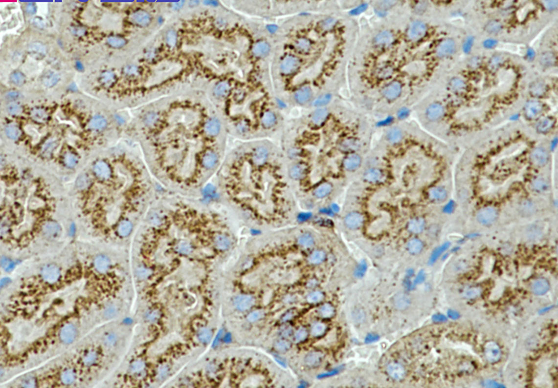 CD63 Rabbit mAb ABZ2506