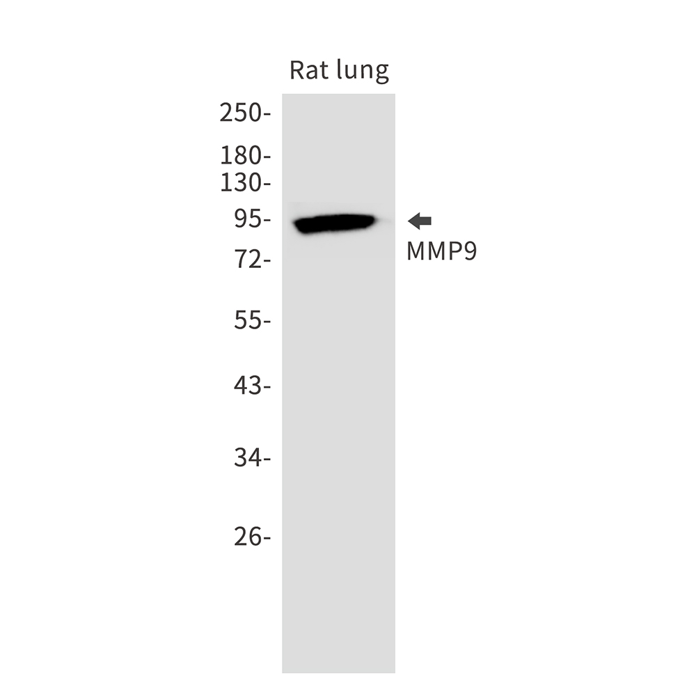 MMP9 Rabbit mAb ABZ2508