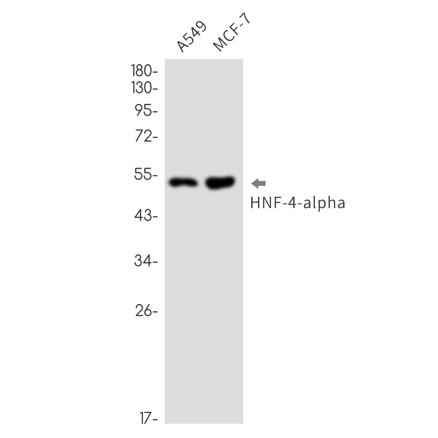 HNF 4 alpha Rabbit mAb ABZ2509