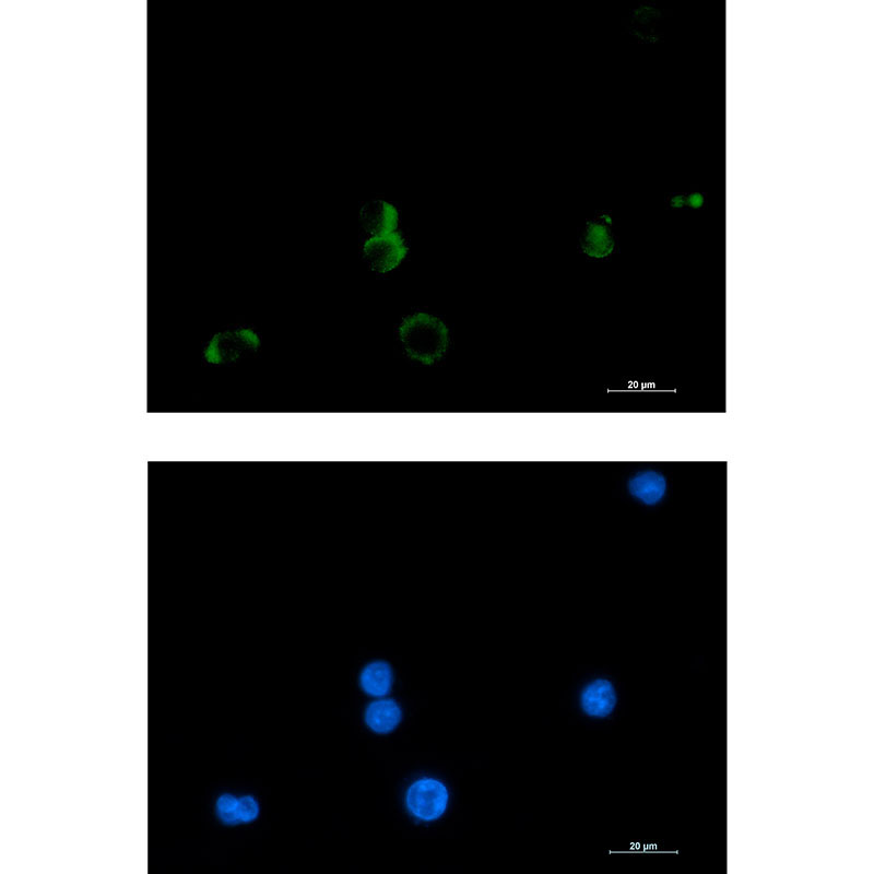 Prostaglandin D Synthase Rabbit mAb ABZ2510