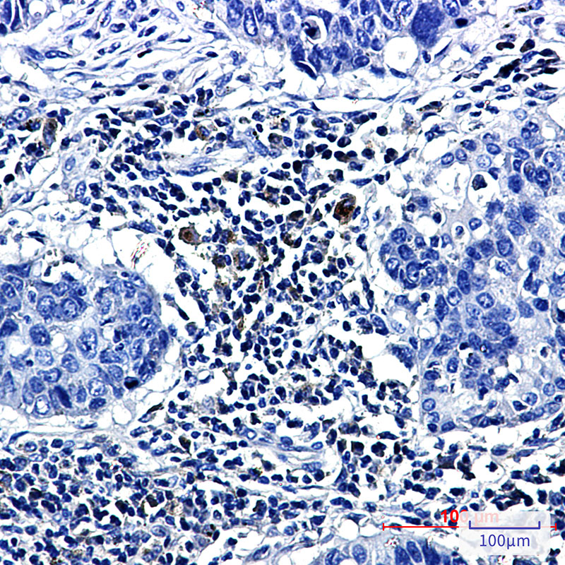 Prostaglandin D Synthase Rabbit mAb ABZ2510