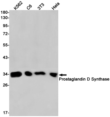 Prostaglandin D Synthase Rabbit mAb ABZ2510