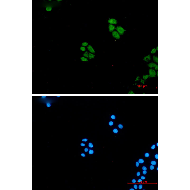 Wnt5a Rabbit mAb ABZ2511