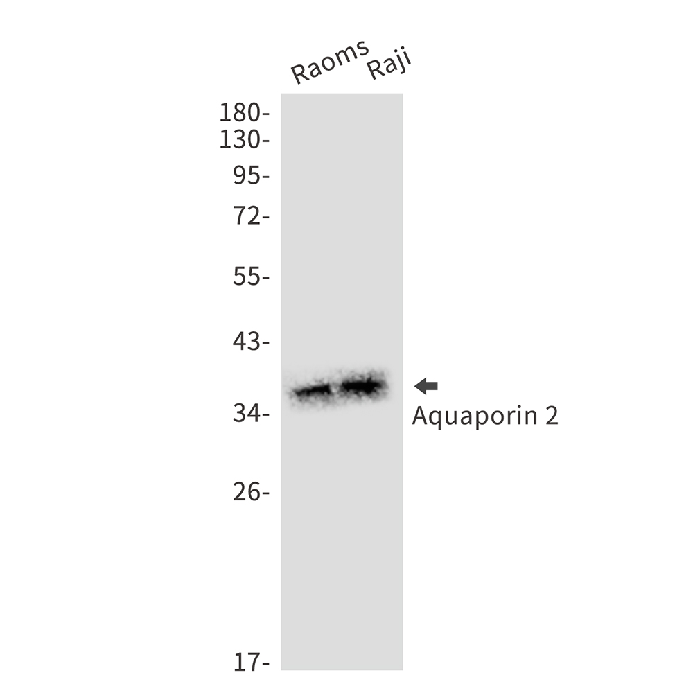 Aquaporin 2 Rabbit mAb ABZ2512