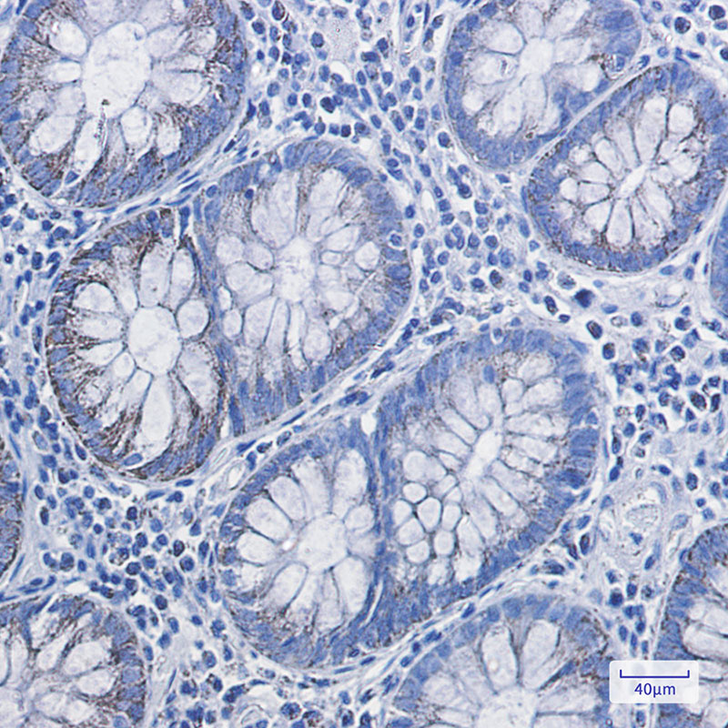 HADHA Rabbit mAb ABZ2513
