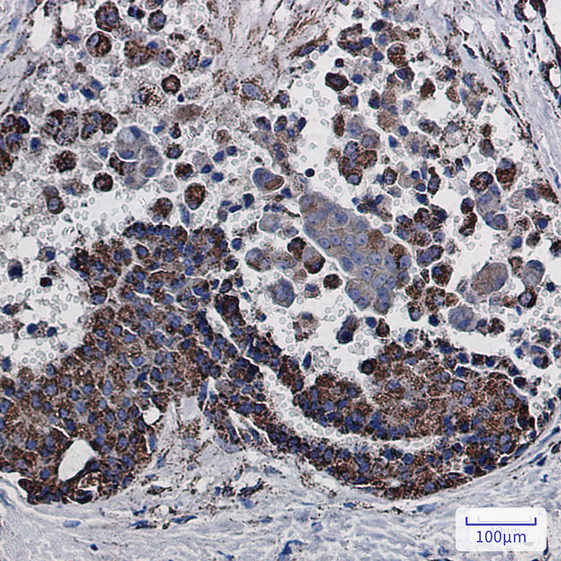 MDH2 Rabbit mAb ABZ2514