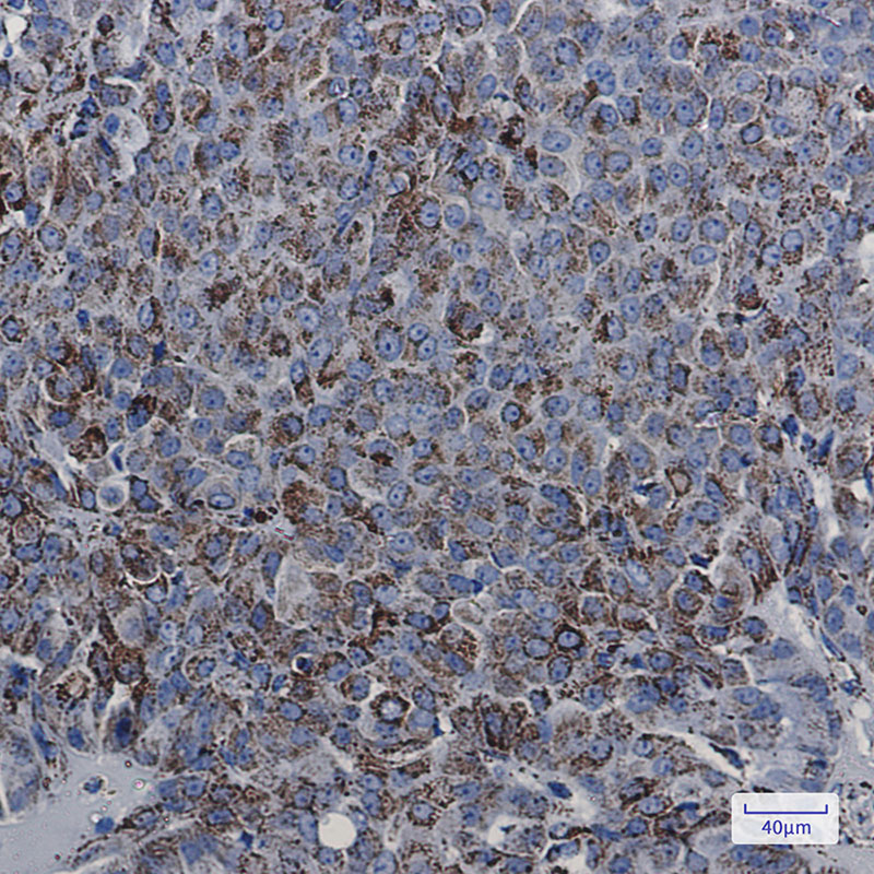 MDH2 Rabbit mAb ABZ2515
