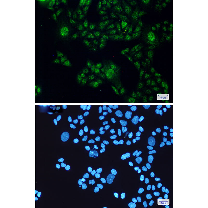 STAT3 Rabbit mAb ABZ2517