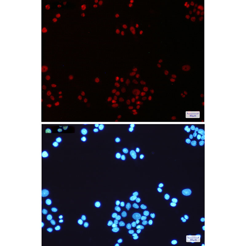 MLH1 Rabbit mAb ABZ2518