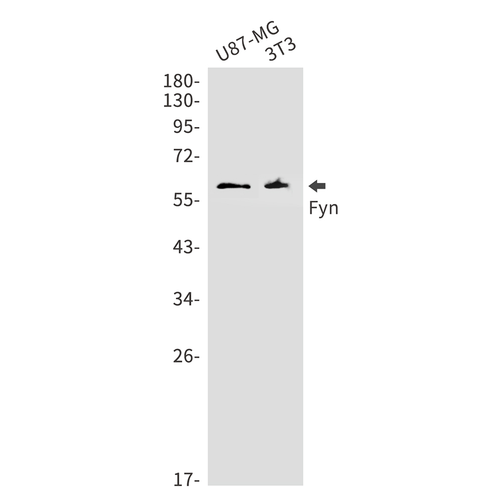 FYN Rabbit mAb ABZ2522