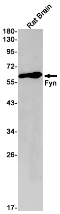 FYN Rabbit mAb ABZ2522