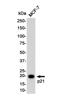 p21 Rabbit mAb ABZ2523