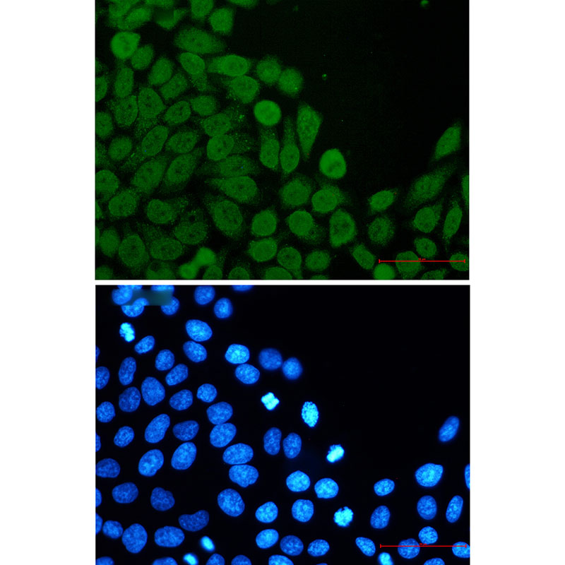 eIF4A3 Rabbit mAb ABZ2524