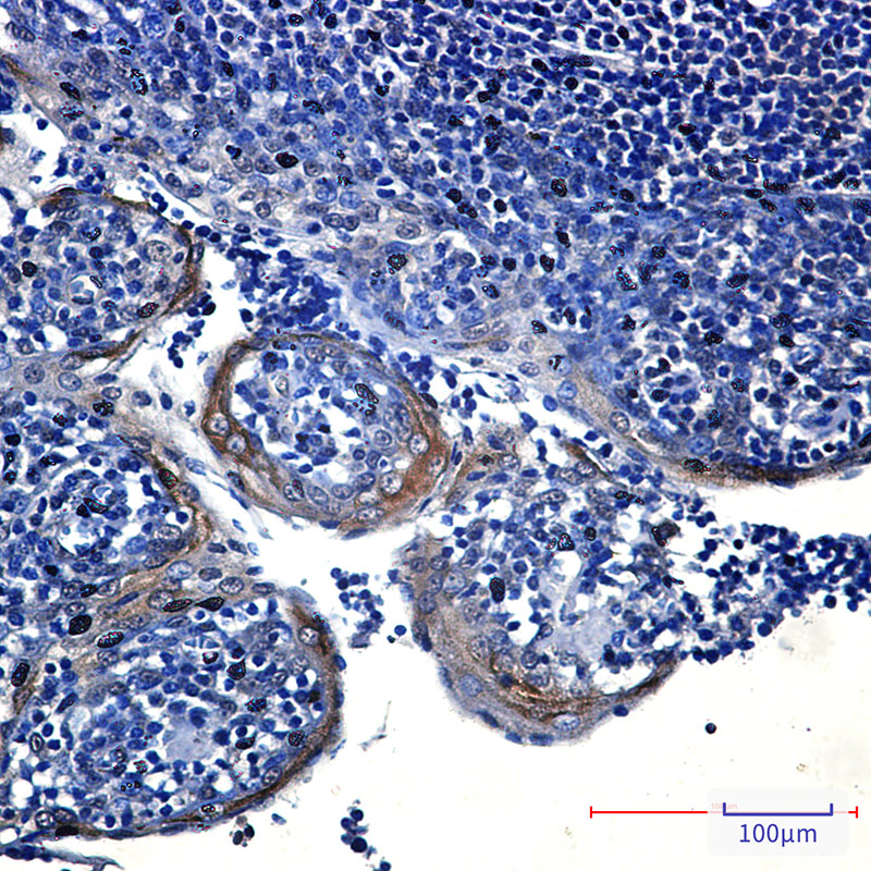 eIF4A3 Rabbit mAb ABZ2524