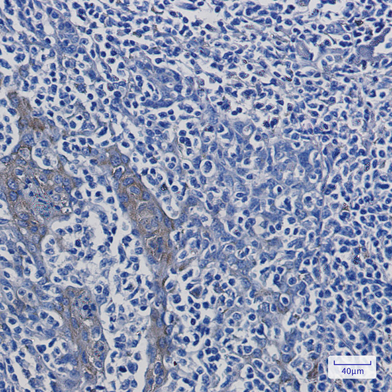ATP6V1A Rabbit mAb ABZ2525