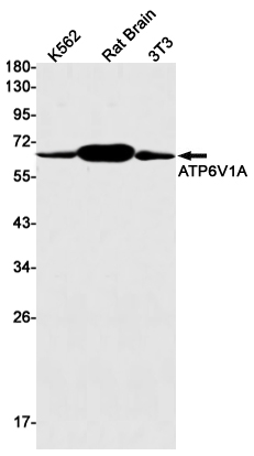 ATP6V1A Rabbit mAb ABZ2525
